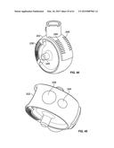 MONITORING AND NOISE MASKING OF THERMAL THERAPY diagram and image