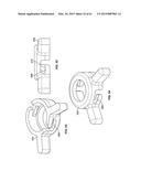 MONITORING AND NOISE MASKING OF THERMAL THERAPY diagram and image