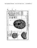 MONITORING AND NOISE MASKING OF THERMAL THERAPY diagram and image