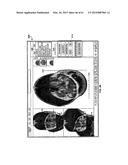 MONITORING AND NOISE MASKING OF THERMAL THERAPY diagram and image