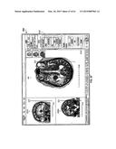 MONITORING AND NOISE MASKING OF THERMAL THERAPY diagram and image