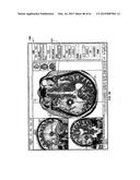 MONITORING AND NOISE MASKING OF THERMAL THERAPY diagram and image