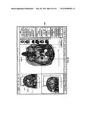 MONITORING AND NOISE MASKING OF THERMAL THERAPY diagram and image