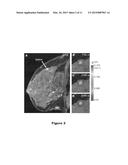 METHOD AND APPARATUS USING MAGNETIC RESONANCE IMAGING FOR TISSUE     PHENOTYPING AND MONITORING diagram and image