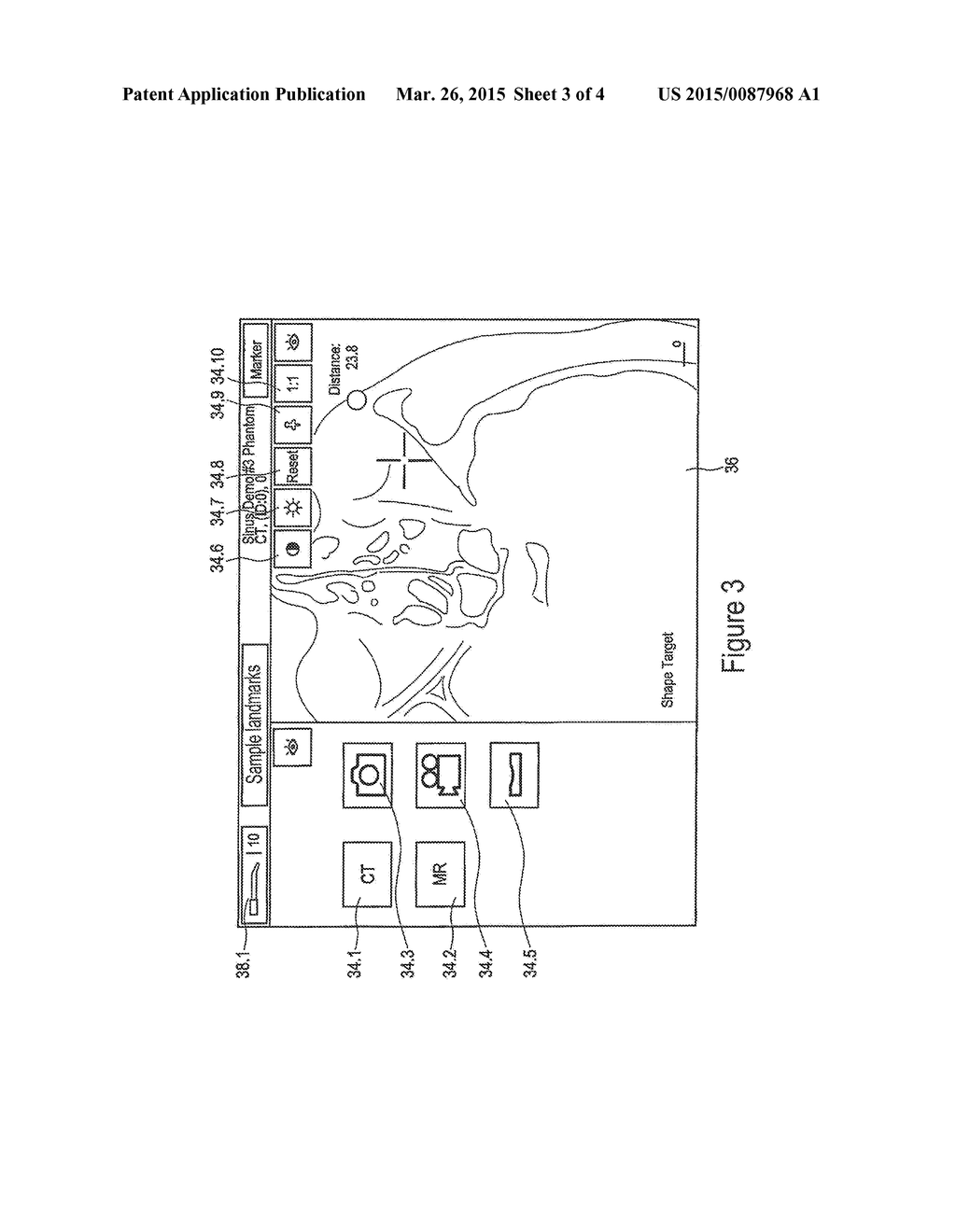 MEDICAL NAVIGATION SYSTEM WITH WIRELESSLY CONNECTED, TOUCH-SENSITIVE     SCREEN - diagram, schematic, and image 04