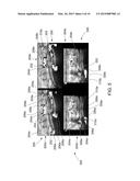 METHOD AND SYSTEM FOR LESION DETECTION IN ULTRASOUND IMAGES diagram and image