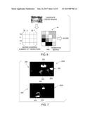 METHOD AND SYSTEM FOR LESION DETECTION IN ULTRASOUND IMAGES diagram and image