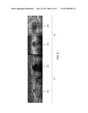 METHOD AND SYSTEM FOR LESION DETECTION IN ULTRASOUND IMAGES diagram and image