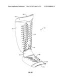 ORTHOPEDIC DEVICE diagram and image