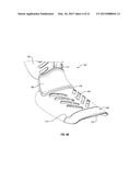 ORTHOPEDIC DEVICE diagram and image