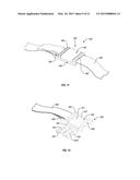 ORTHOPEDIC DEVICE diagram and image