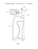 ORTHOPEDIC DEVICE diagram and image