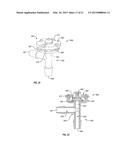 ORTHOPEDIC DEVICE diagram and image