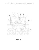 Apparatus and Method for Transdermal Fluid Delivery diagram and image