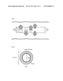 METHOD AND DEVICE FOR TREATING VENOUS INSUFFICIENCY AND VARICOSE VEINS diagram and image