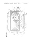 AUTOMATED PERITONEAL DIALYSIS SYSTEM USING STEPPER MOTOR diagram and image