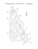 AUTOMATED PERITONEAL DIALYSIS SYSTEM USING STEPPER MOTOR diagram and image