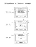 AUTOMATED PERITONEAL DIALYSIS SYSTEM USING STEPPER MOTOR diagram and image