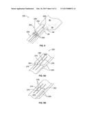 CATHETER HUB diagram and image