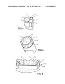 SPREADING IMPLEMENT diagram and image