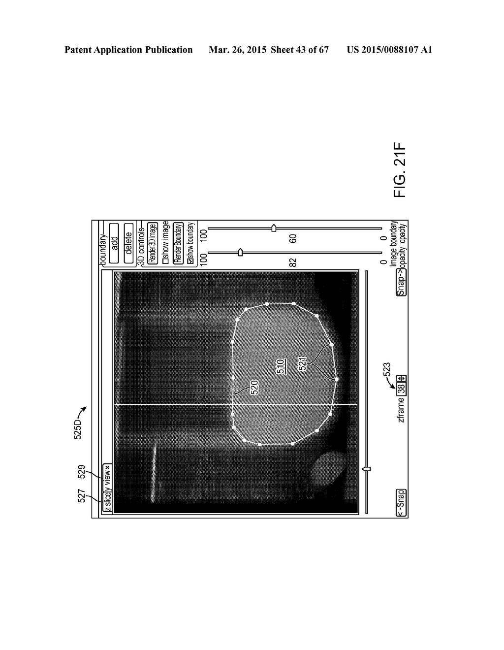 AUTOMATED IMAGE-GUIDED TISSUE RESECTION AND TREATMENT - diagram, schematic, and image 44