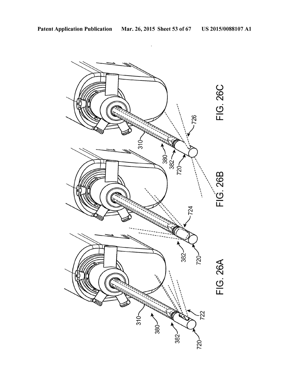 AUTOMATED IMAGE-GUIDED TISSUE RESECTION AND TREATMENT - diagram, schematic, and image 54