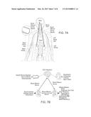 RENAL NEUROMODULATION METHODS AND SYSTEMS FOR TREATMENT OF     HYPERALDOSTERONISM diagram and image