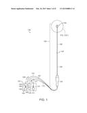 CRYOTHERAPEUTIC DEVICES FOR RENAL NEUROMODULATION AND ASSOCIATED SYSTEMS     AND METHODS diagram and image