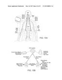 CRYOTHERAPEUTIC DEVICES FOR RENAL NEUROMODULATION AND ASSOCIATED SYSTEMS     AND METHODS diagram and image