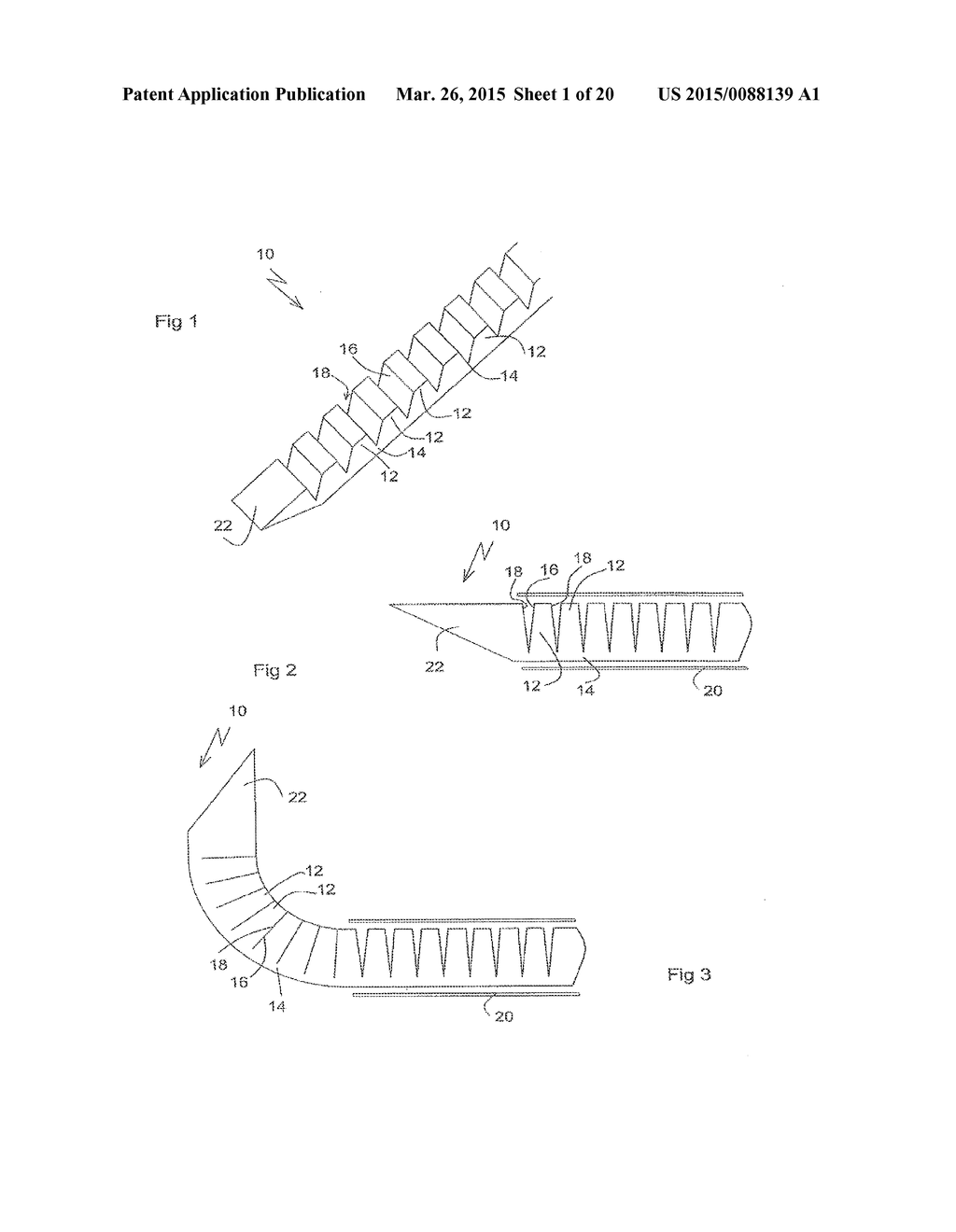 DEVICES FOR INTRODUCTION INTO A BODY VIA A SUBSTANTIALLY  STRAIGHT CONDUIT     TO FORM A PREDEFINED CURVED  CONFIGURATION, AND METHODS EMPLOYING SUCH     DEVICES - diagram, schematic, and image 02