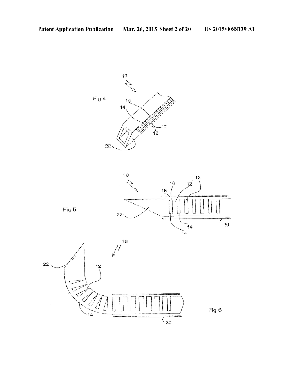 DEVICES FOR INTRODUCTION INTO A BODY VIA A SUBSTANTIALLY  STRAIGHT CONDUIT     TO FORM A PREDEFINED CURVED  CONFIGURATION, AND METHODS EMPLOYING SUCH     DEVICES - diagram, schematic, and image 03