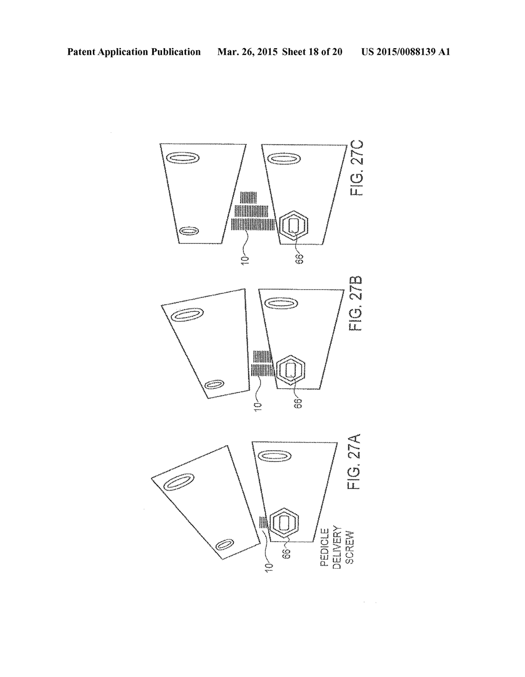 DEVICES FOR INTRODUCTION INTO A BODY VIA A SUBSTANTIALLY  STRAIGHT CONDUIT     TO FORM A PREDEFINED CURVED  CONFIGURATION, AND METHODS EMPLOYING SUCH     DEVICES - diagram, schematic, and image 19