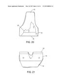 PATIENT SPECIFIC INSTRUMENT diagram and image