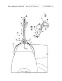 TISSUE TENSIONING DEVICES AND RELATED METHODS diagram and image