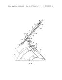 TISSUE TENSIONING DEVICES AND RELATED METHODS diagram and image