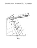 TISSUE TENSIONING DEVICES AND RELATED METHODS diagram and image