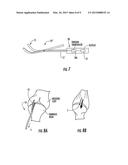 TISSUE TENSIONING DEVICES AND RELATED METHODS diagram and image