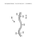 SUTURE FOR SOFT TISSUE REPAIR diagram and image