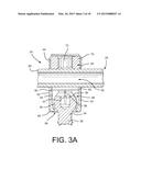 Method of Using Spine Stabilization System With Dynamic Screw diagram and image