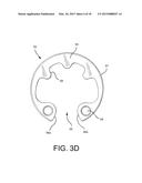 Method of Using Spine Stabilization System With Dynamic Screw diagram and image