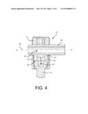 Method of Using Spine Stabilization System With Dynamic Screw diagram and image