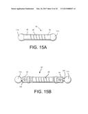 Method of Using Spine Stabilization System With Dynamic Screw diagram and image