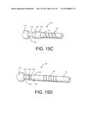 Method of Using Spine Stabilization System With Dynamic Screw diagram and image