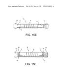 Method of Using Spine Stabilization System With Dynamic Screw diagram and image