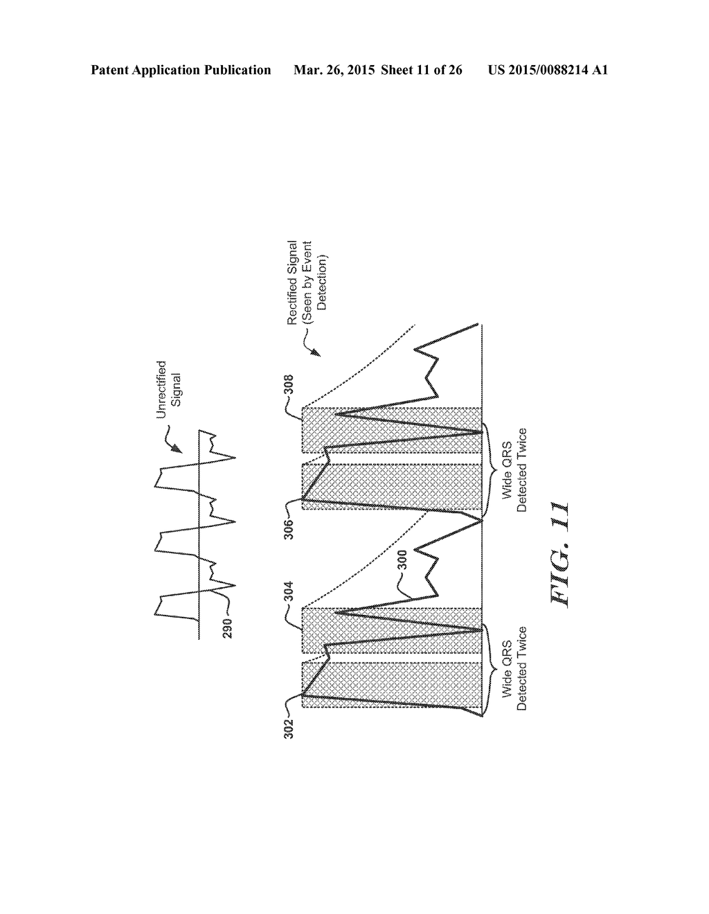 METHODS AND DEVICES FOR ACCURATELY CLASSIFYING CARDIAC ACTIVITY - diagram, schematic, and image 12