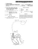 IMPLANTABLE CARDIAC STIMULATION DEVICE AND METHOD THAT STABILIZES     VENTRICULAR RATE DURING EPISODES OF ATRIAL FIBRILLATION diagram and image