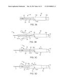 SHEATHS USED WITH POLYMER SCAFFOLDS diagram and image