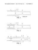 Transluminal Delivery System diagram and image