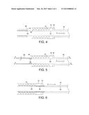 Transluminal Delivery System diagram and image