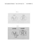 Spinal Cord Devices and Methods for Promoting Axonal Regeneration diagram and image